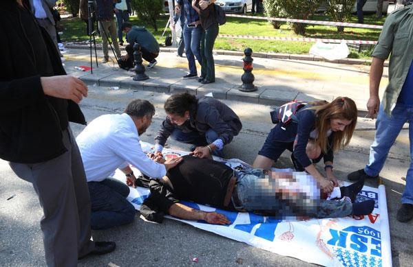 Ankara'da bomba patladı: 95 can kaybı 12