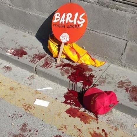 Ankara'da bomba patladı: 95 can kaybı 14