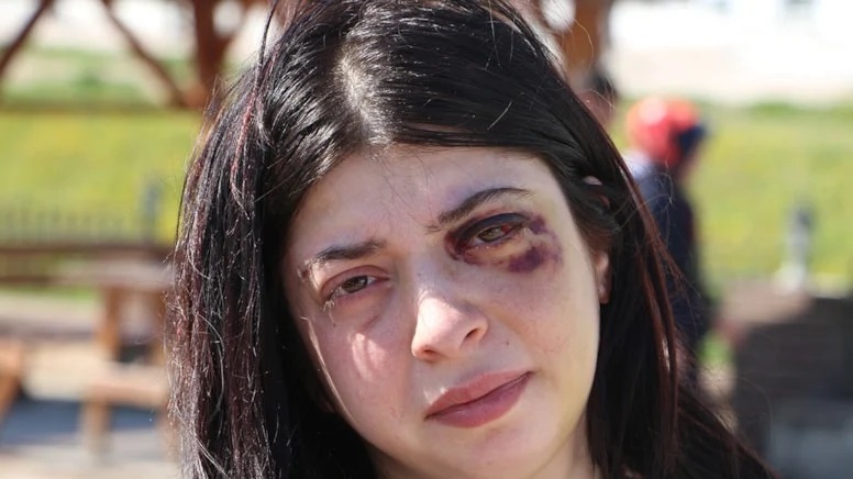 Samsun'da genç kadını 'etek giydiğine göre ücretin ne kadar?' diyerek dövdü