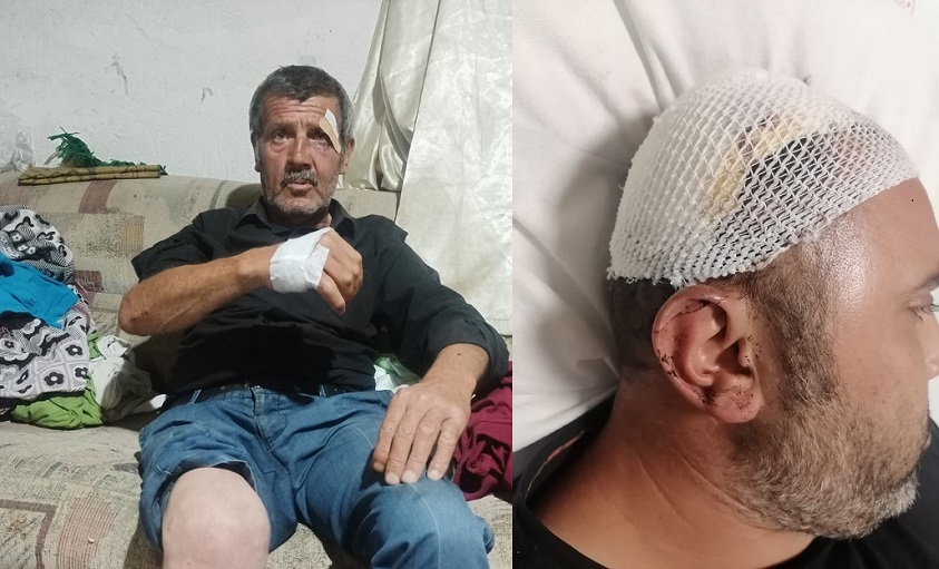 Çankırı'da muhtar ve çocuklarından 'hamile' kadın ve eşine şiddet!