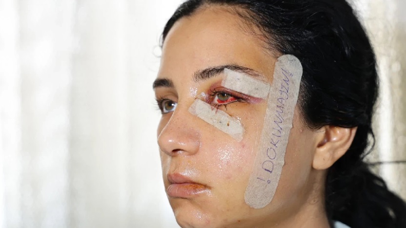 'Şiddet' gören kadının isyanı 'tutuklama'yı getirdi