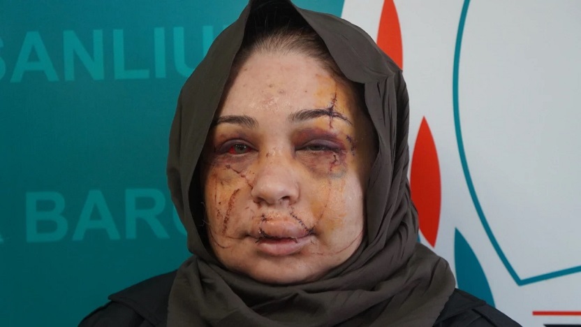 "Güzelliğini elinden alacağım" deyip yüzünü kesen 'polis eş' serbest kaldı