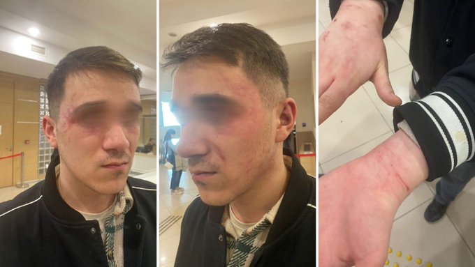 Karakolda işkence iddiası: Saatlerce dövdüler, kola şişesi sokmaya çalıştılar