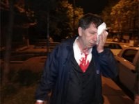 Deneyimli gazeteci Yavuz Selim Demirağ'a çirkin saldırı!