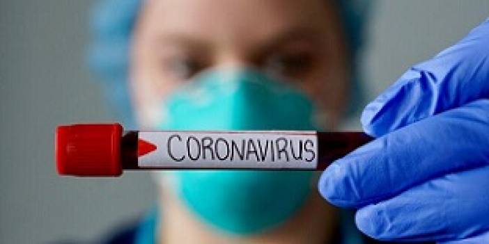 Çankırı'da dün itibariyle Coronavirüslü vaka sayısı 25!